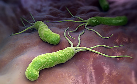 helicobacter-pylori